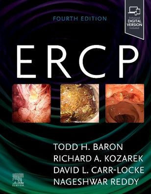 ERCP