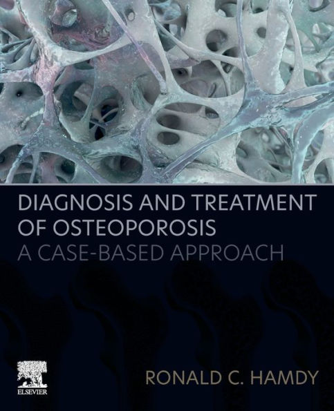 Diagnosis and Treatment of Osteoporosis: A Case-Based Approach