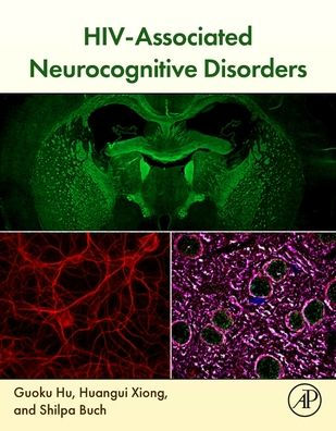 HIV-Associated Neurocognitive Disorders