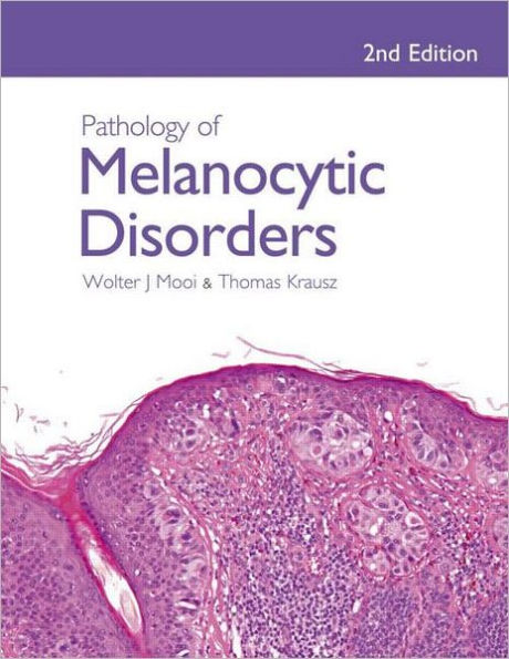 Pathology of Melanocytic Disorders 2ed / Edition 2