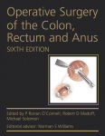 Alternative view 1 of Operative Surgery of the Colon, Rectum and Anus / Edition 6