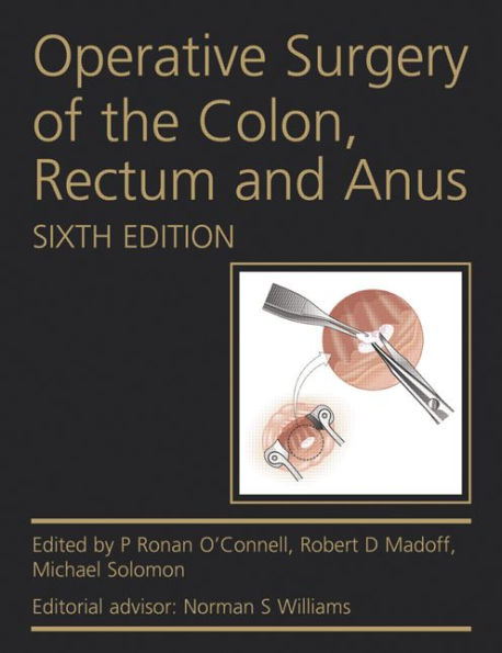 Operative Surgery of the Colon, Rectum and Anus / Edition 6