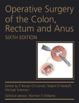 Alternative view 2 of Operative Surgery of the Colon, Rectum and Anus / Edition 6