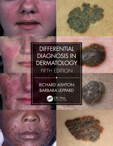 Differential Diagnosis Dermatology