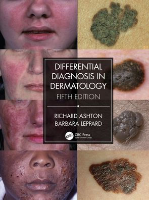 Differential Diagnosis Dermatology