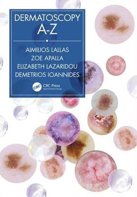 Dermatoscopy A-Z / Edition 1