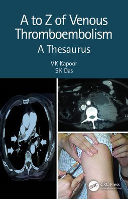 A to Z of Venous Thromboembolism: Thesaurus