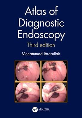 Atlas of Diagnostic Endoscopy, 3E / Edition 3