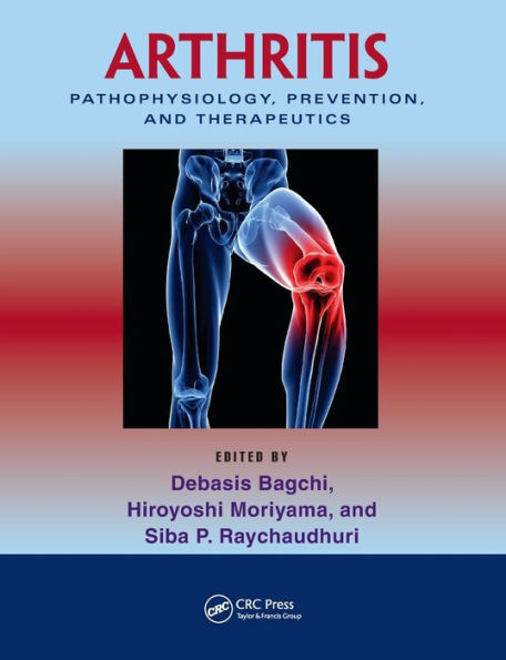 Arthritis: Pathophysiology, Prevention, and Therapeutics / Edition 1