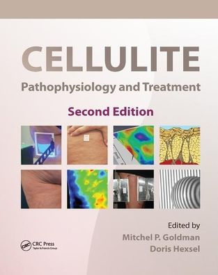 Cellulite: Pathophysiology and Treatment / Edition 2