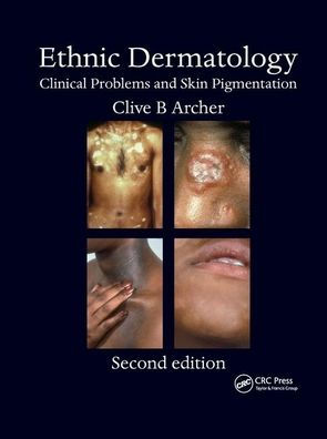 Ethnic Dermatology: Clinical Problems and Skin Pigmentation / Edition 2