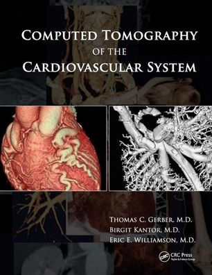 Computed Tomography of the Cardiovascular System / Edition 1