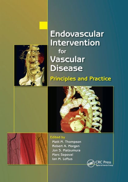 Endovascular Intervention for Vascular Disease: Principles and Practice / Edition 1