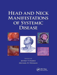 Title: Head and Neck Manifestations of Systemic Disease / Edition 1, Author: Jeffrey P. Harris