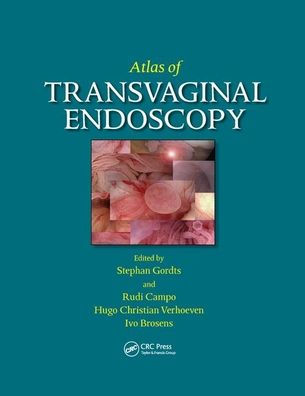 Atlas of Transvaginal Endoscopy / Edition 1