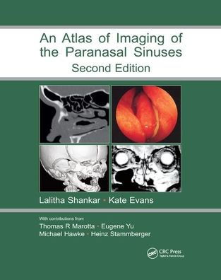 Atlas of Imaging of the Paranasal Sinuses, Second Edition / Edition 2