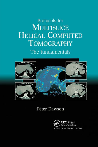 Protocols for Multislice Helical Computed Tomography: The Fundamentals / Edition 1