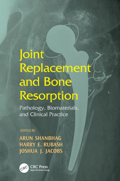 Joint Replacement and Bone Resorption: Pathology, Biomaterials and Clinical Practice / Edition 1