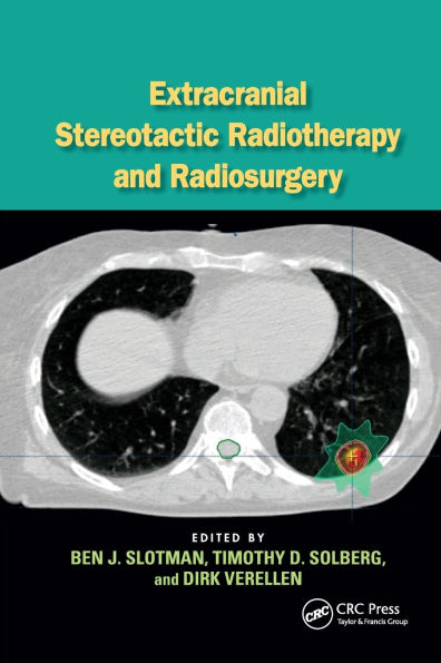 Extracranial Stereotactic Radiotherapy and Radiosurgery / Edition 1