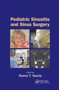 Title: Pediatric Sinusitis and Sinus Surgery / Edition 1, Author: Ramzi T. Younis