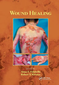 Title: Wound Healing / Edition 1, Author: Anna Falabella
