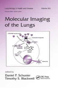 Title: Molecular Imaging of the Lungs / Edition 1, Author: Daniel Schuster