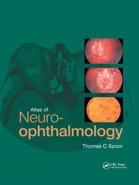 Atlas of Neuro-ophthalmology