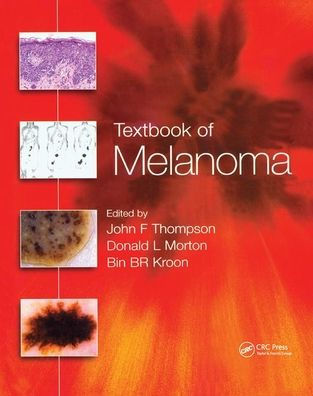 Textbook of Melanoma: Pathology, Diagnosis and Management / Edition 1