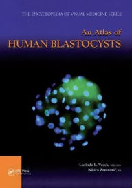 Title: An Atlas of Human Blastocysts / Edition 1, Author: Lucinda L. Veeck