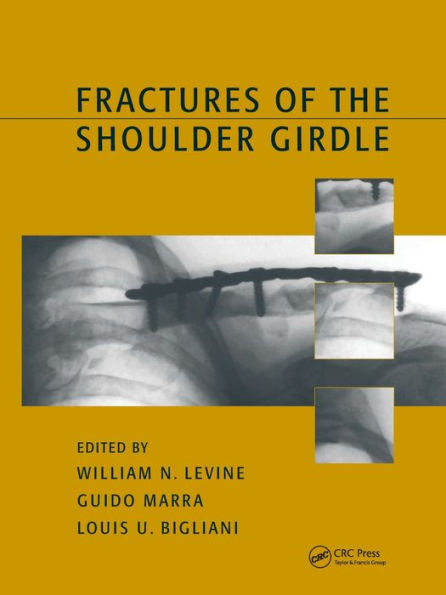 Fractures of the Shoulder Girdle / Edition 1