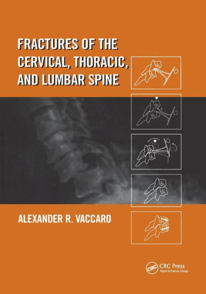 Fractures of the Cervical, Thoracic, and Lumbar Spine / Edition 1