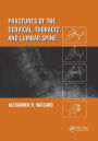 Fractures of the Cervical, Thoracic, and Lumbar Spine