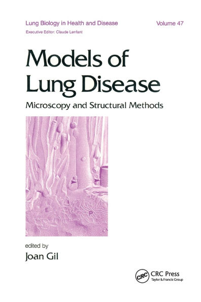 Models of Lung Disease: Microscopy and Structural Methods / Edition 1