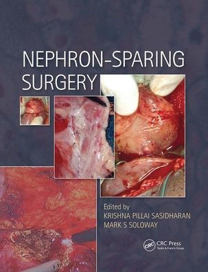 Nephron-Sparing Surgery / Edition 1