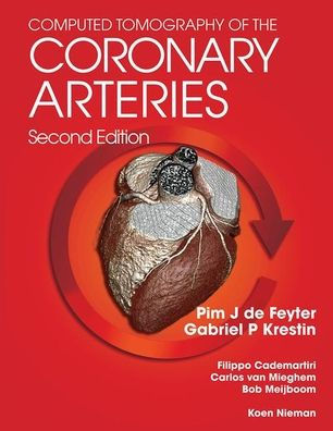 Computed Tomography of the Coronary Arteries / Edition 2