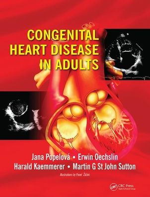 Congenital Heart Disease in Adults / Edition 1