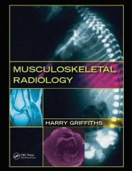 Title: Musculoskeletal Radiology / Edition 1, Author: Harry Griffiths