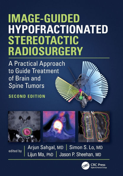 Image-Guided Hypofractionated Stereotactic Radiosurgery: A Practical Approach to Guide Treatment of Brain and Spine Tumors