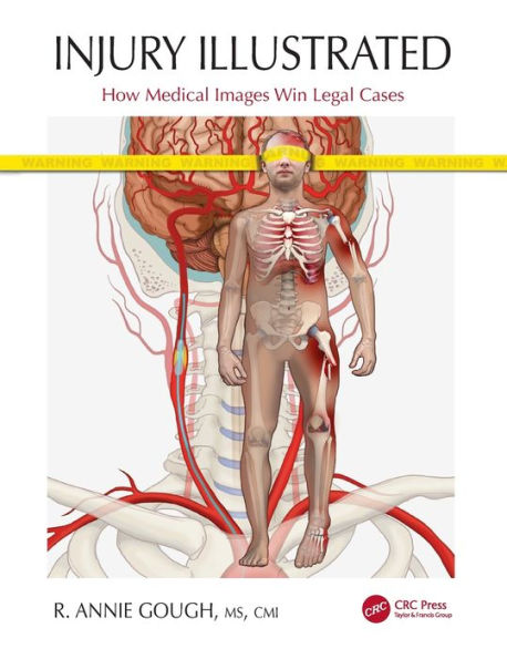 Injury Illustrated: How Medical Images Win Legal Cases