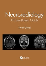 Title: Neuroradiology: A Case-Based Guide, Author: Swati Goyal