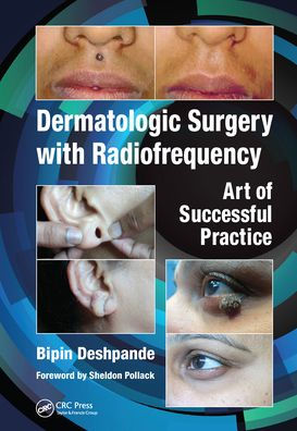 Dermatologic Surgery with Radiofrequency: Art of Successful Practice