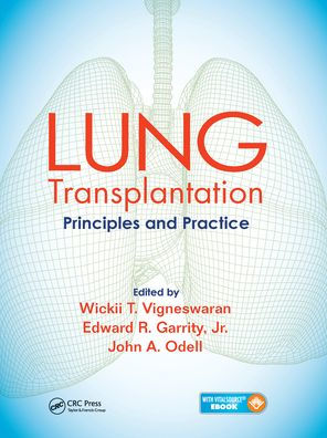 Lung Transplantation: Principles and Practice