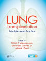 Lung Transplantation: Principles and Practice
