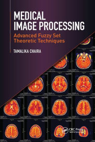 Title: Medical Image Processing: Advanced Fuzzy Set Theoretic Techniques, Author: Tamalika Chaira