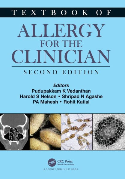 Textbook of Allergy for the Clinician