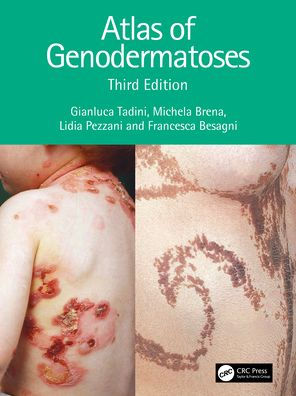 Atlas of Genodermatoses