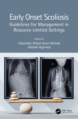 Early Onset Scoliosis: Guidelines for Management Resource-Limited Settings