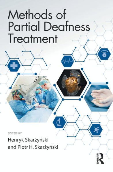 Methods of Partial Deafness Treatment