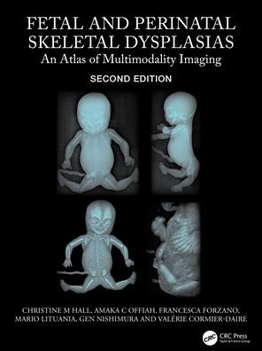 Fetal and Perinatal Skeletal Dysplasias: An Atlas of Multimodality Imaging