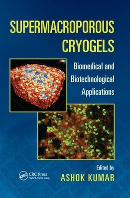 Supermacroporous Cryogels: Biomedical and Biotechnological Applications